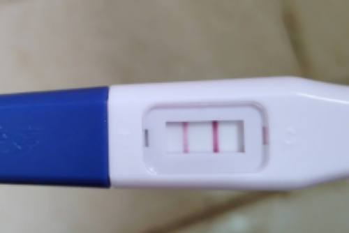 南京代生哪里可靠,试管婴儿取卵经历分享与疼痛感受解析
