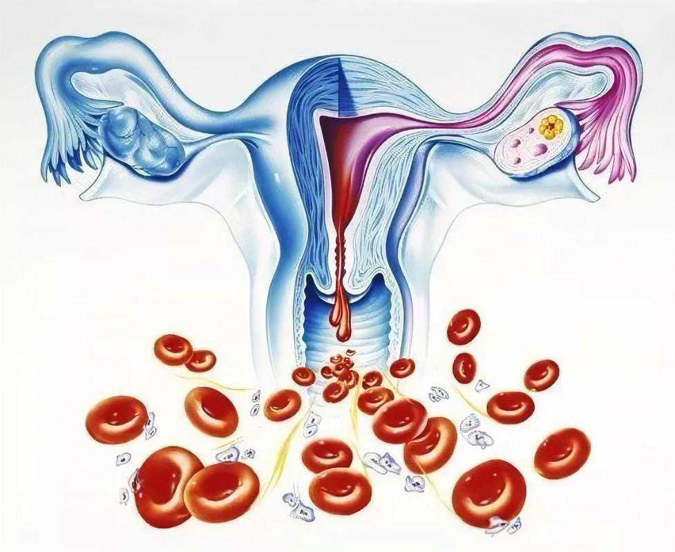 排卵期出血怎么了？非经期出血2情况，5大原因一次看