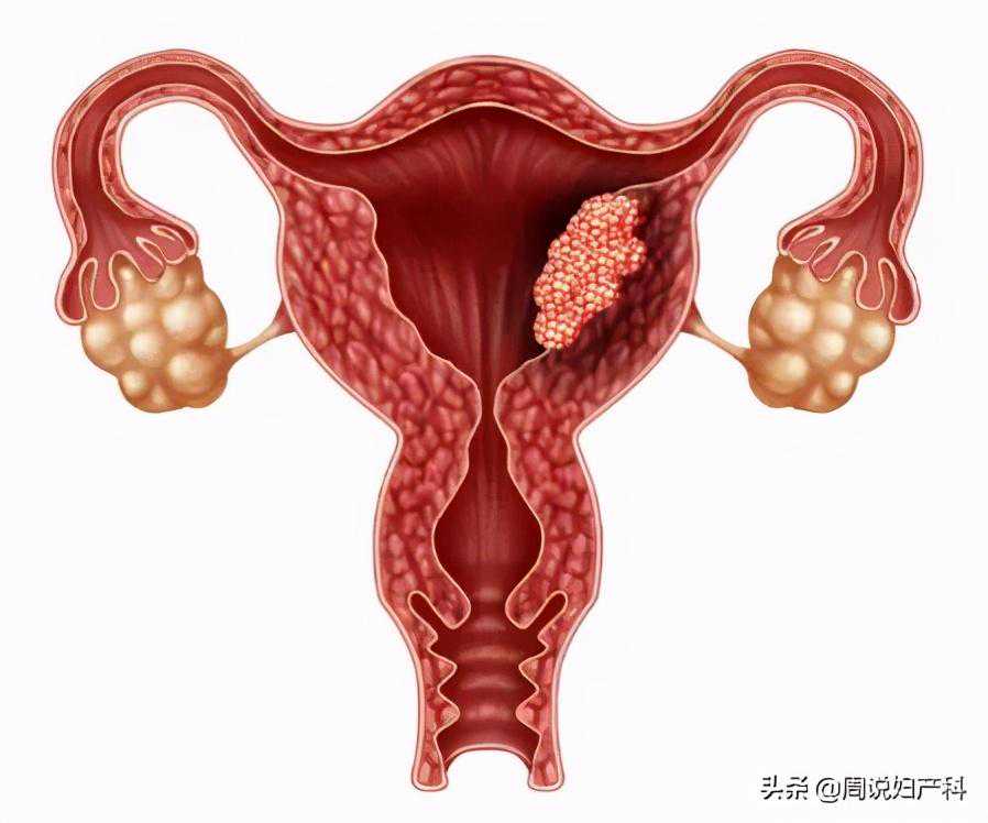 43岁女性月经期子宫内膜厚度正常